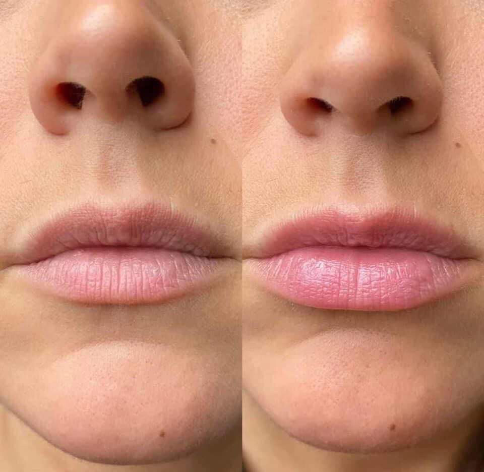 Lip Plumping Balm x 1