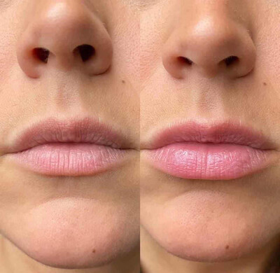 Lip Plumping Balm x 1