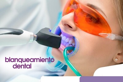 Aclaramiento Dental + Profilaxis