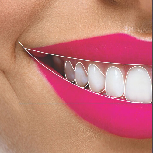 Diseño Digital Sonrisa