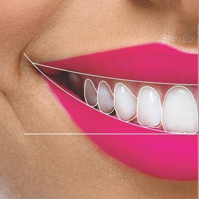 Diseño Digital Sonrisa