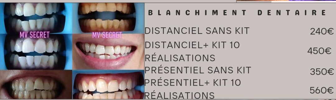 Kit De Blanchiment Dentaire Beauty&Smile Avec Machine - Neuf En Boîte, Formation Incluse, Made In France