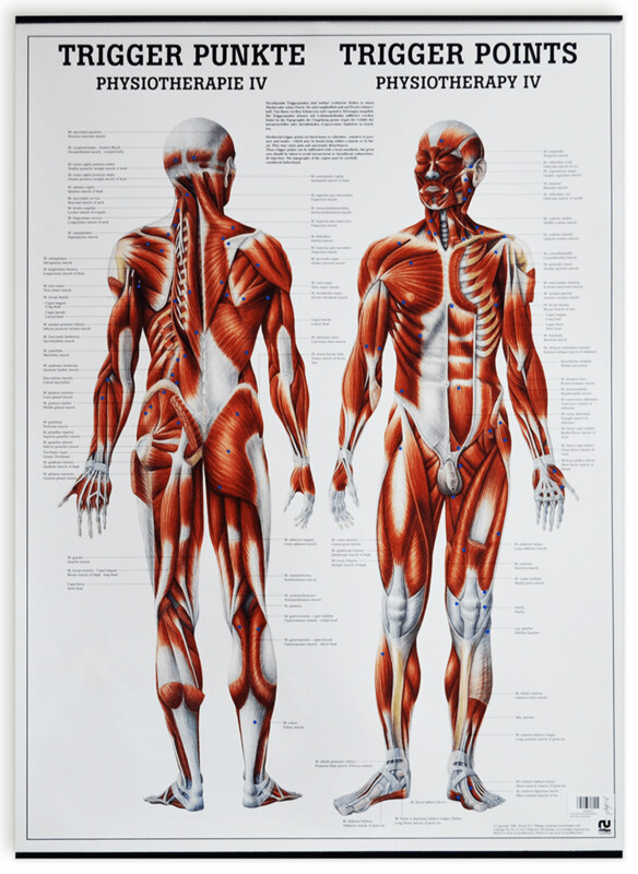 Planche anatomique, Points Trigger, 20x27&quot;, (50x70cm), Anglais