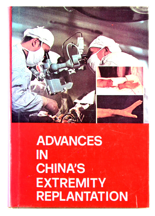 Advances in China&#39;s extremity replantation