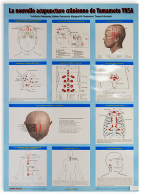 Planche de la nouvelle acupuncture crânienne de Yamamoto, YNSA