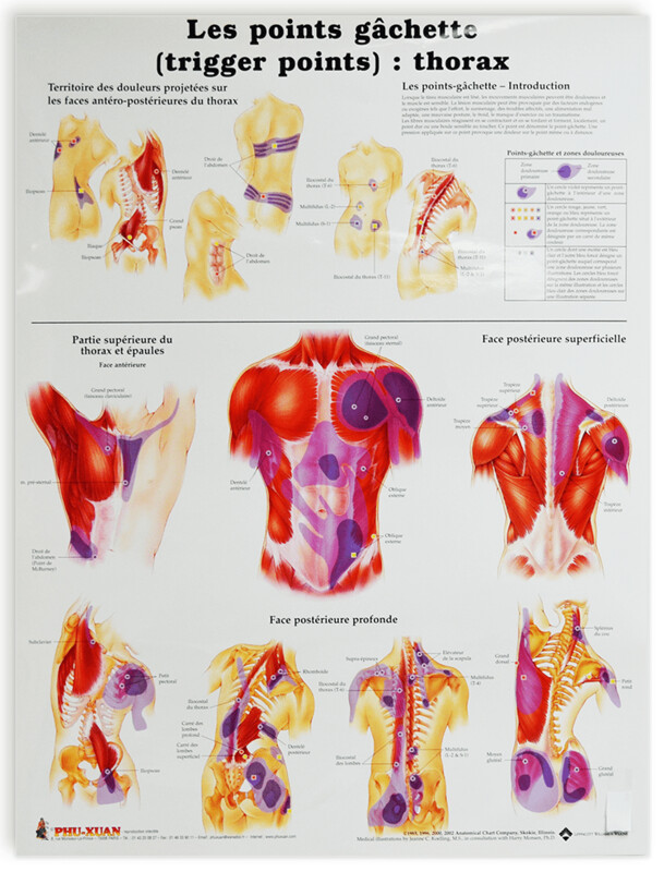 Planche des points gachette, (trigger points), Thorax et extrémités, set de 2 planches