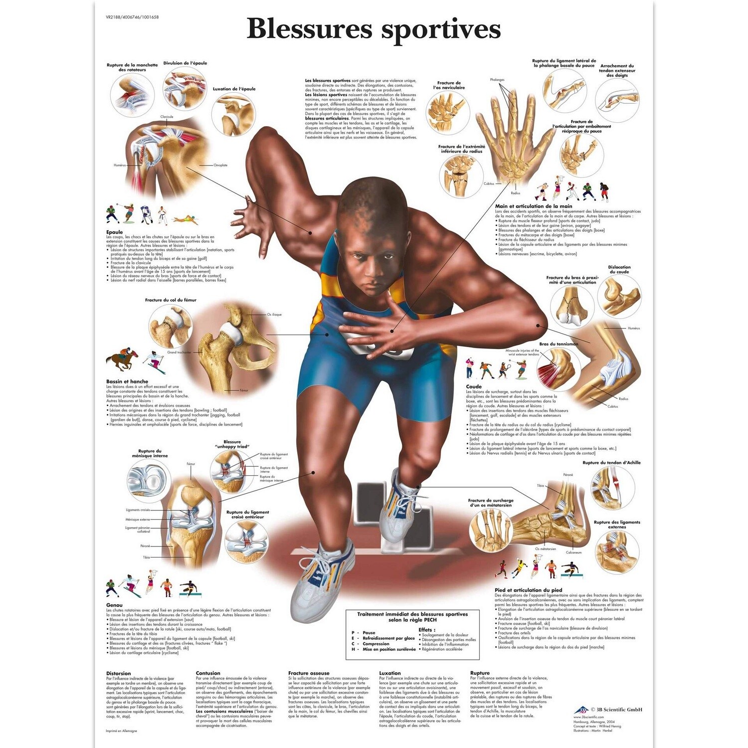 Blessures sportives, Planche, 20&quot;x26&quot;, (50 x 67 cm) Français, Laminée ou Papier: Papier