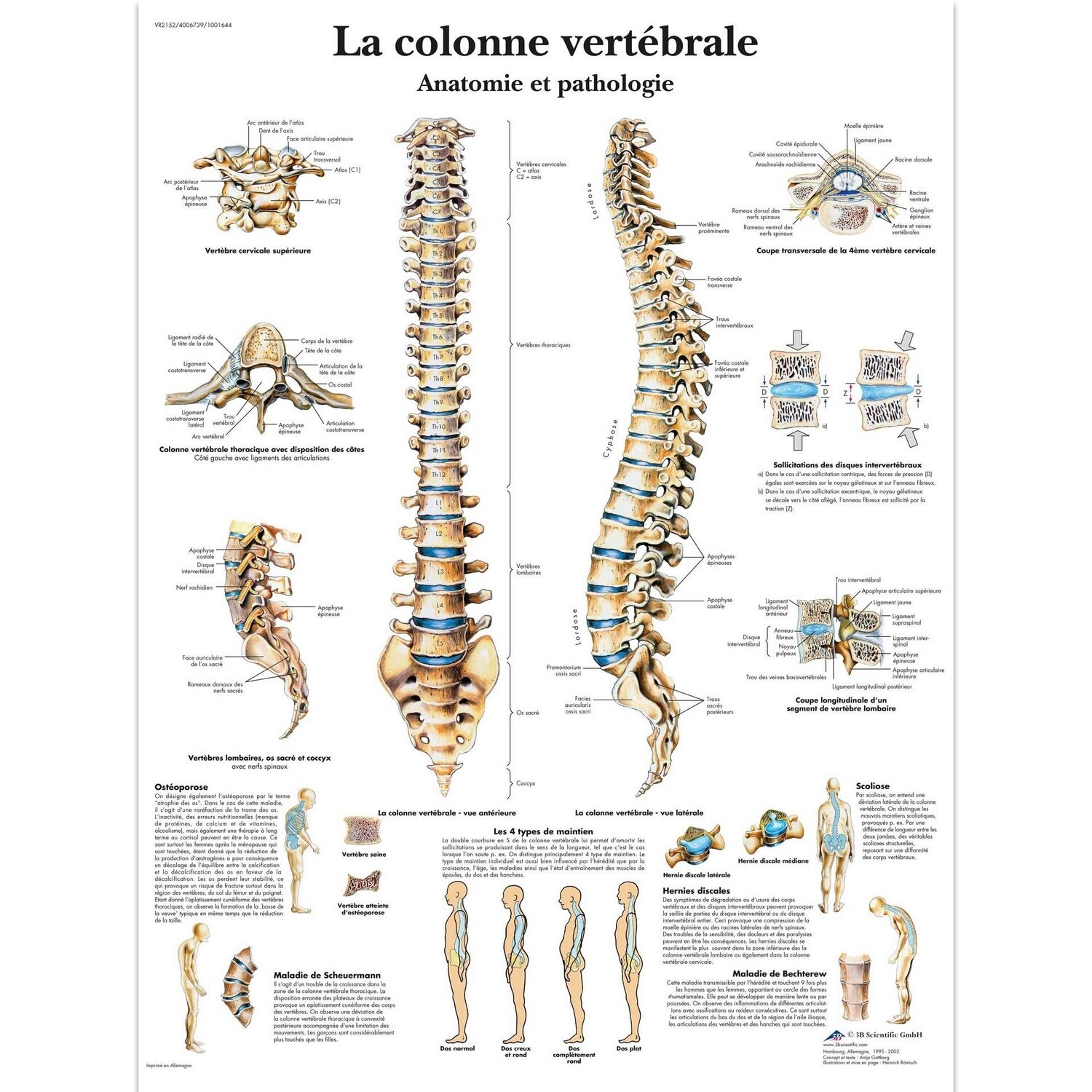 La colonne vertébrale, Anatomie et pathologie, Planche, 20&quot;x26&quot;, (50 x 67 cm) Français, Poster: Plastifiée