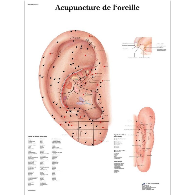 L’acupuncture de l&#39;oreille, Planche, 20&quot;x26&quot;, (50 x 67 cm) Français