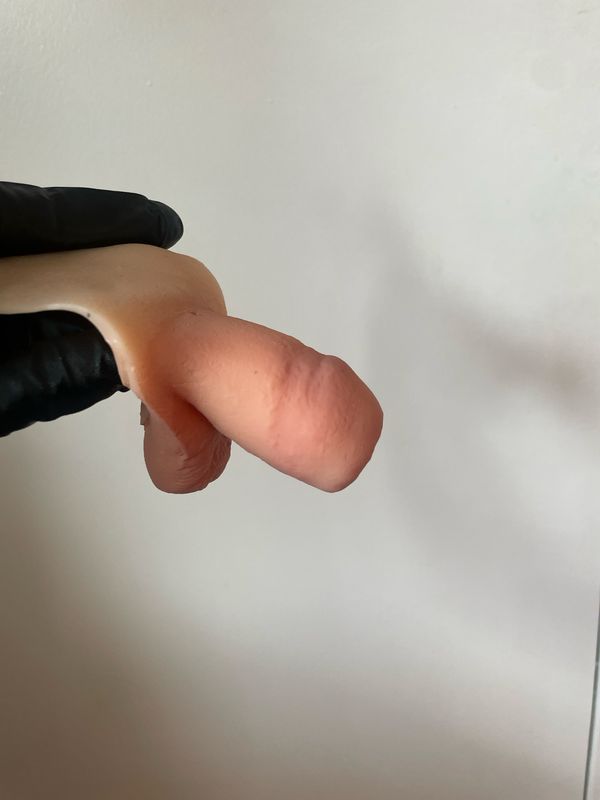 Weisswurst ((First Phalloplasty Packer Ever!)) Weisswurst ((First Phalloplasty Packer Ever!))
