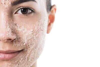PEELING