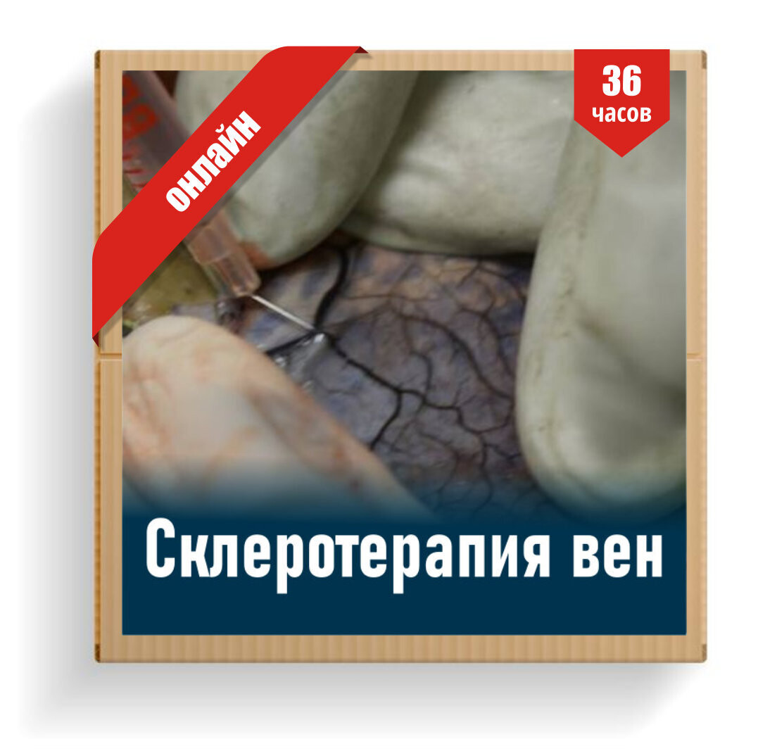 Склеротерапия вен