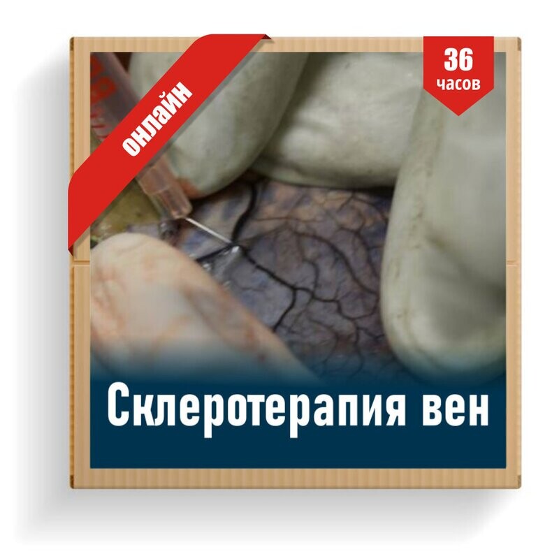 Склеротерапия вен