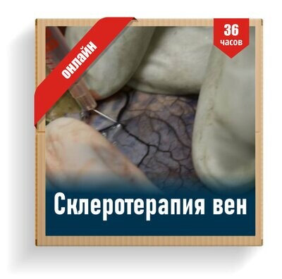 Склеротерапия вен