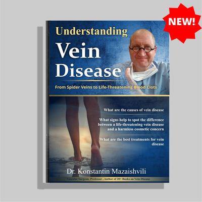 Understanding vein disease: From Spider Veins to Life-Threatening Blood Clots