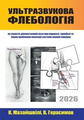 Ultrasound Phlebology: How to Piece Together the Diagnostic Puzzle for Varicose Veins, Thrombosis, and Other Problems of the Venous System of the Lower Extremities Ultrasound Phlebology: How to Piece Together the Diagnostic Puzzle for Varicose Veins, Thrombosis, and Other Problems of the Venous System of the Lower Extremities