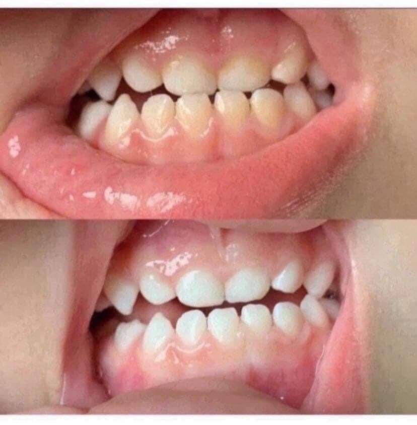 Whitening Toothpaste