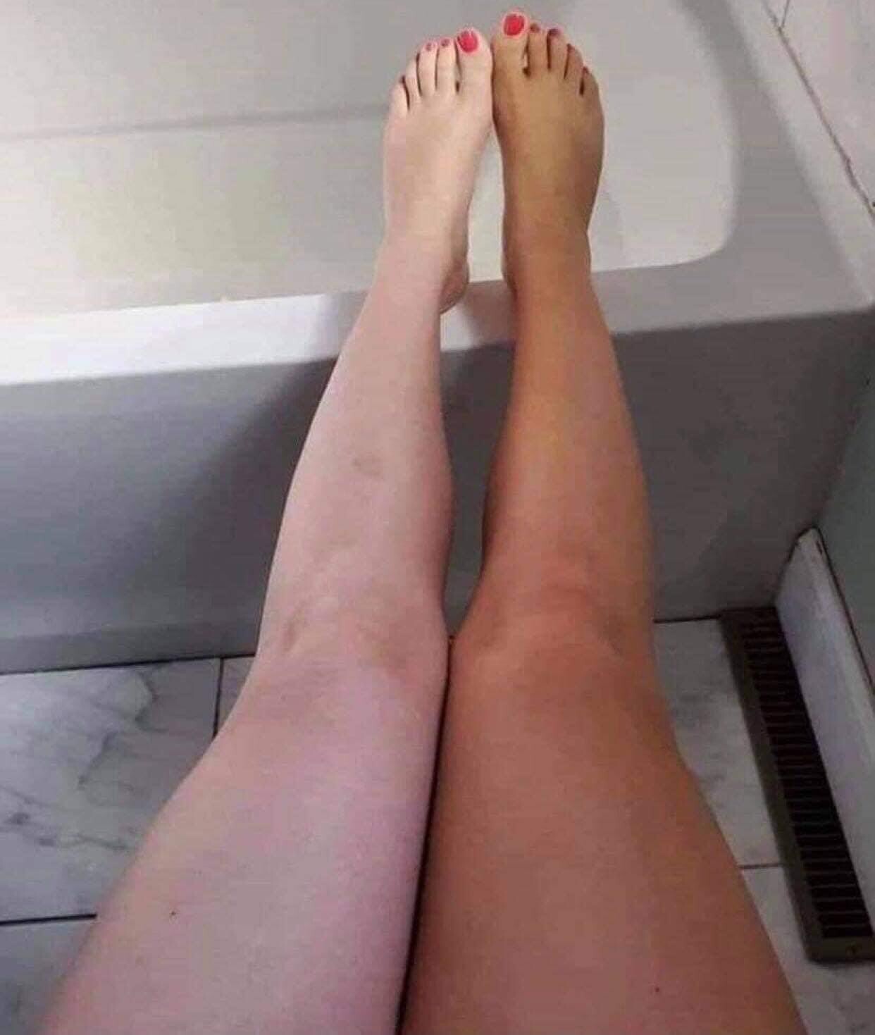 Sunless tanner