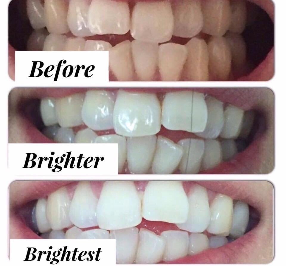 Sunless tanner &amp; whitening toothpaste bundle 🤎🤍