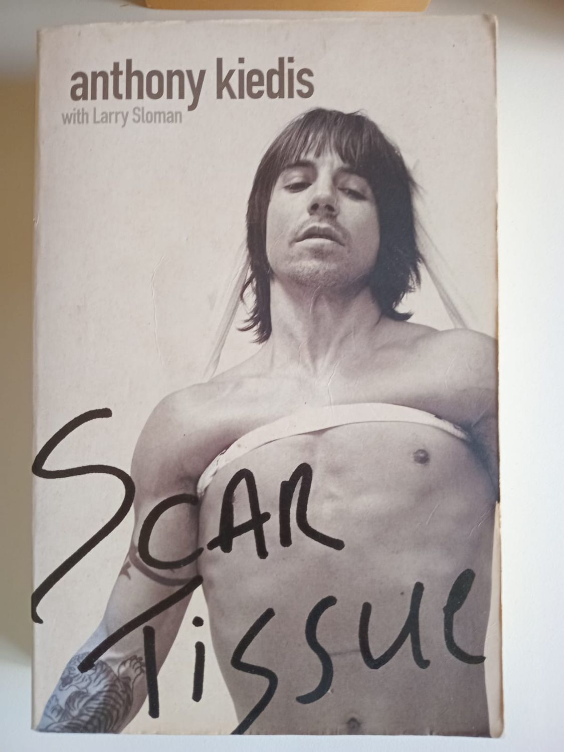 Scar tissue 90