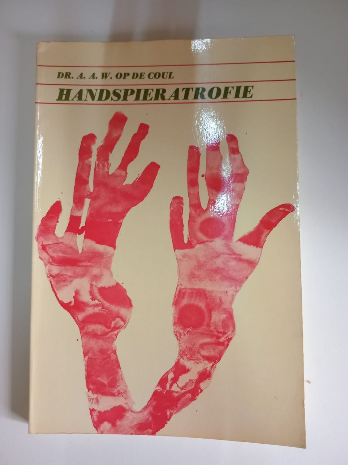 Handspieratrofie 131