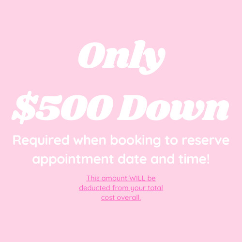 Composite Veneers Deposit ONLY*