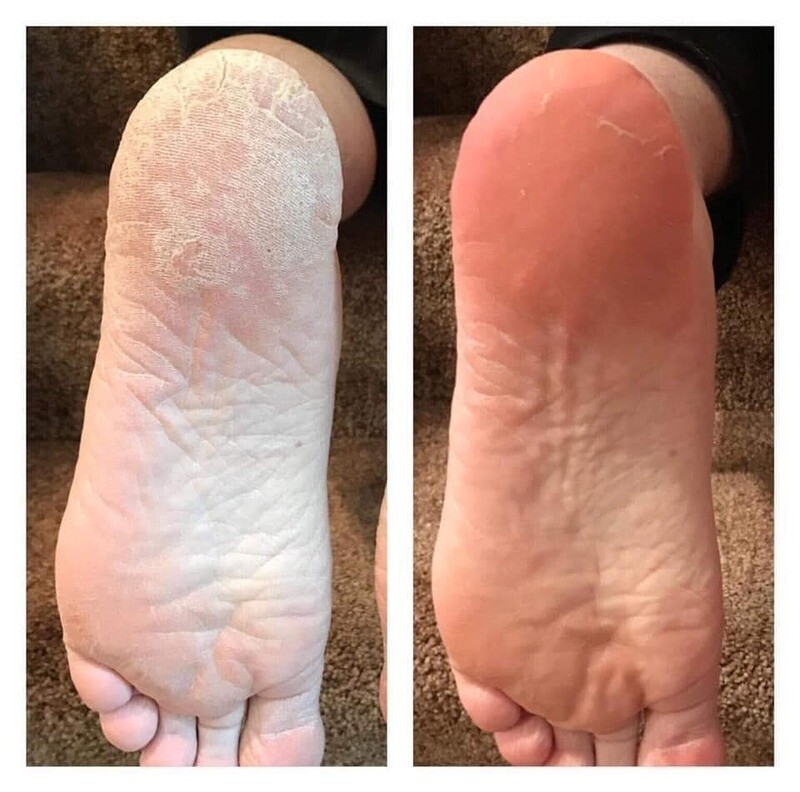 Sole Solutions