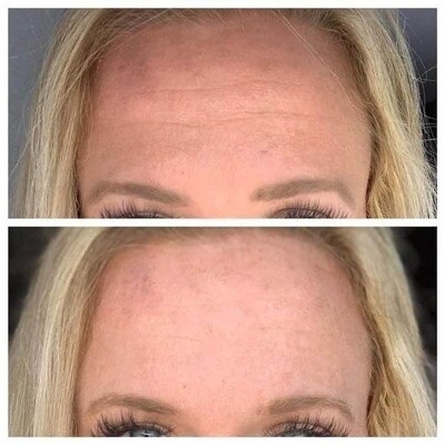 Line Corrector