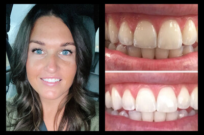 Whitening Toothpaste