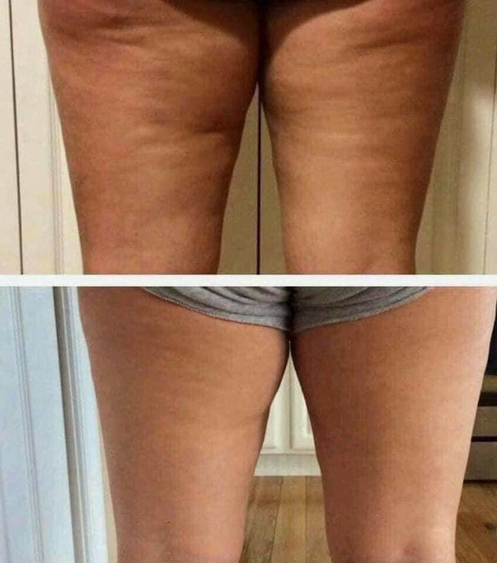 Firming Cream aka Dermatic Effects