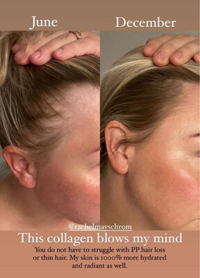 Collagen Powder