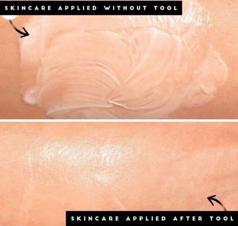 Micro-needling Device &amp; Kit