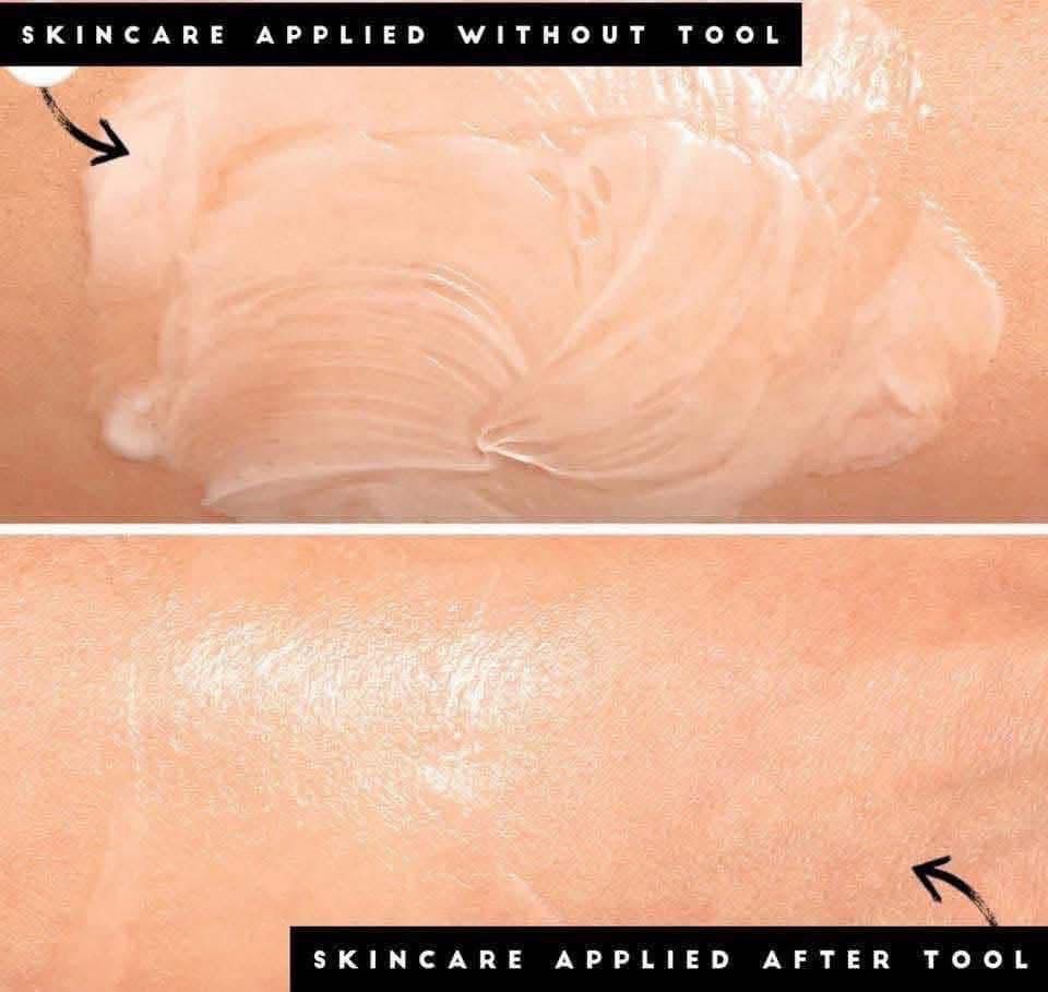 Micro-needling Device &amp; Kit