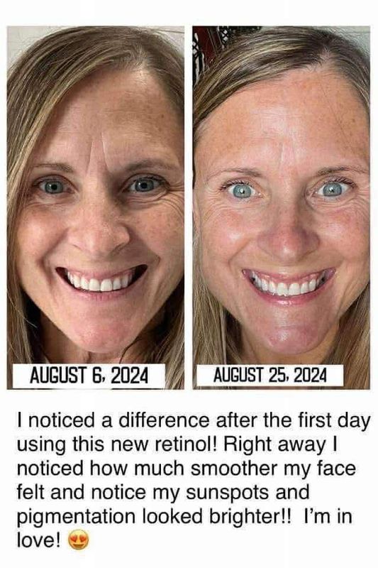 Retinol