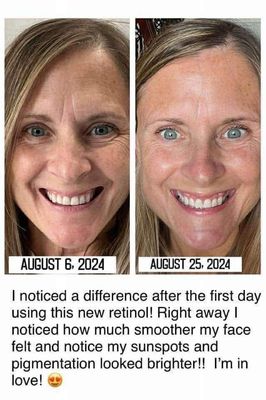 Retinol