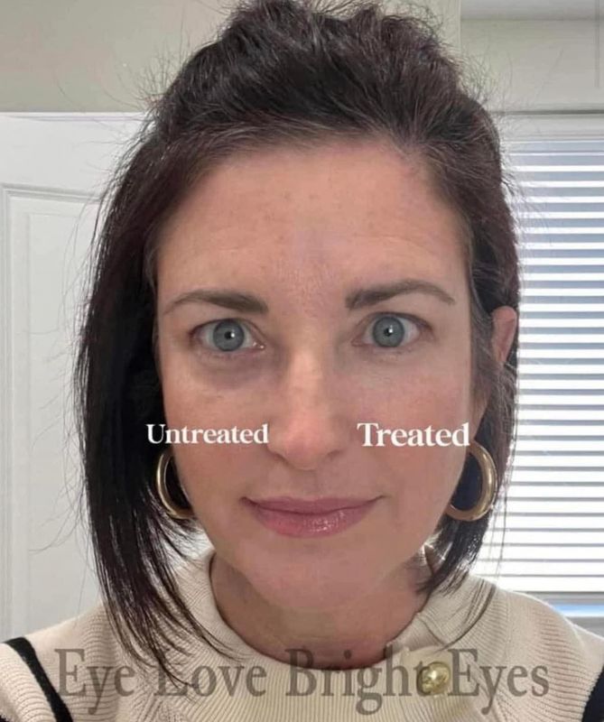 Eye Love Bright Eyes