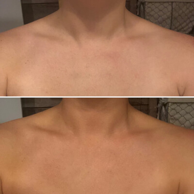 Sunless Tanner