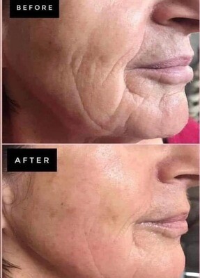 Uplifting Cream