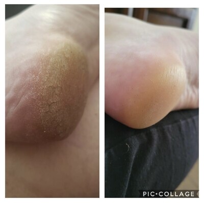 Pedicure Cream