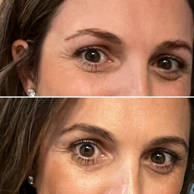 Lash + Brow Serum