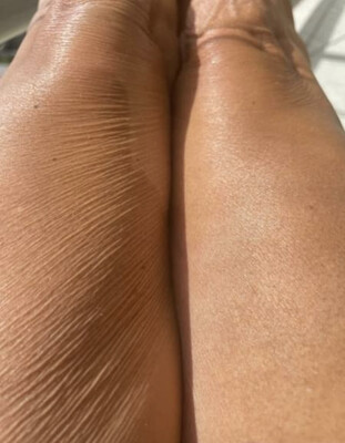 Firming Cream/Cellulite Lotion