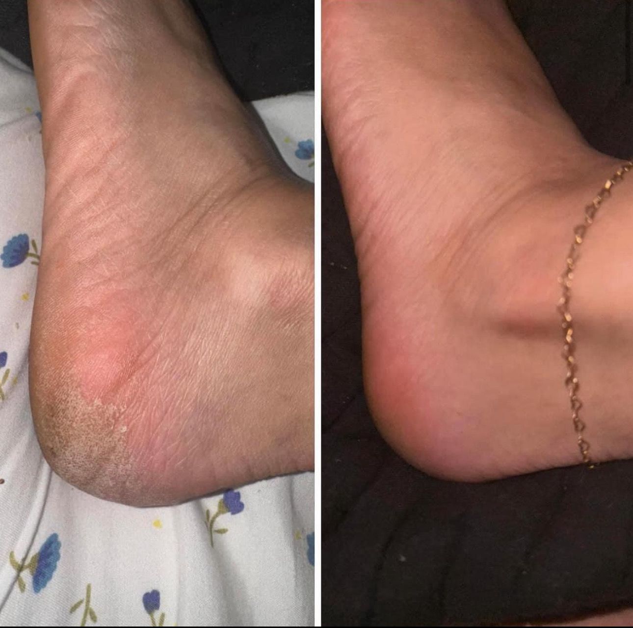 Pedi In A Bottle