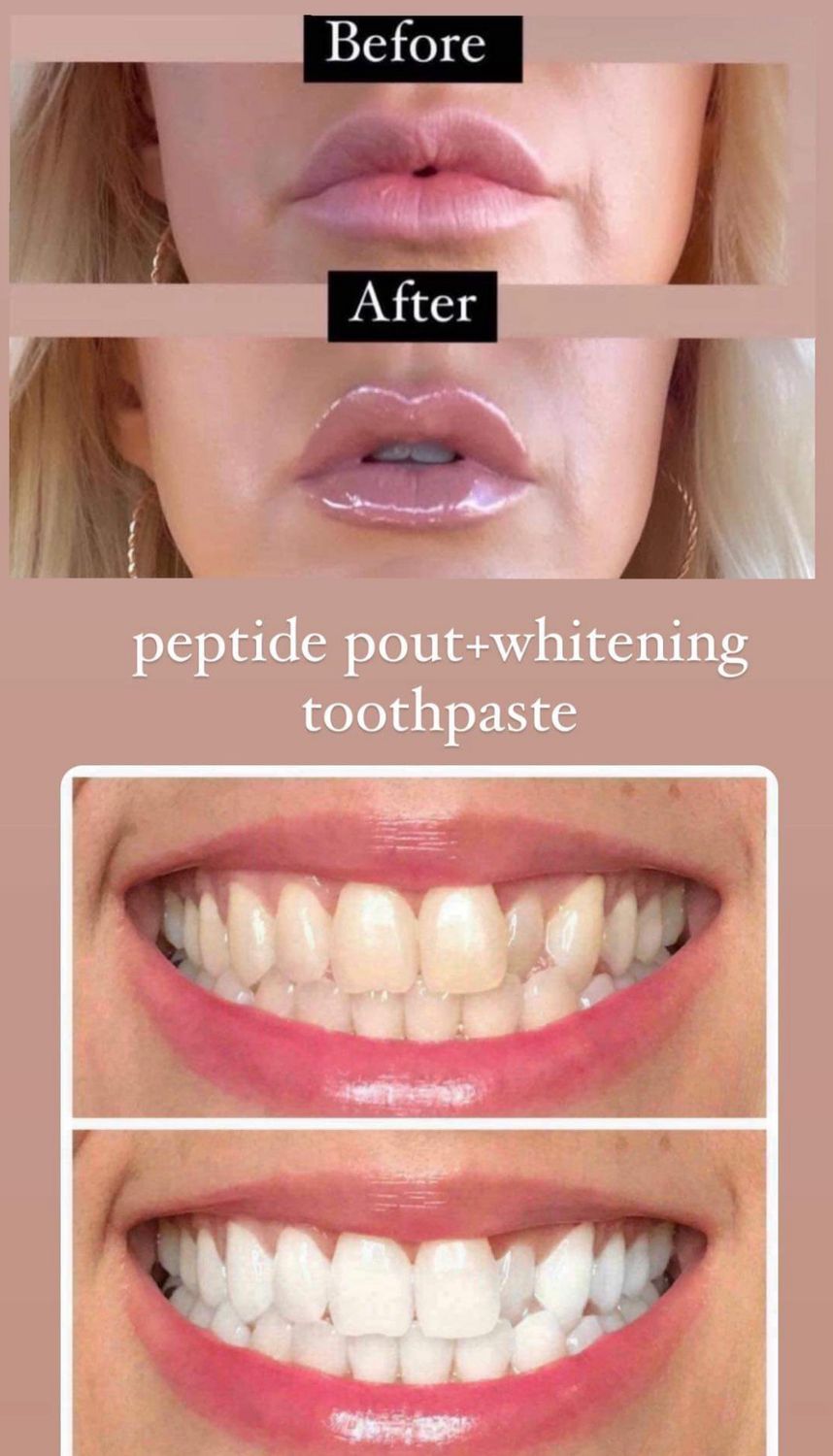 Anti Aging Lip Plumping Gloss plus Whitening Toothpaste Bundle 