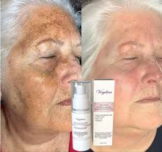 Virgelina Ultra-Potent 2% Hydroquinone