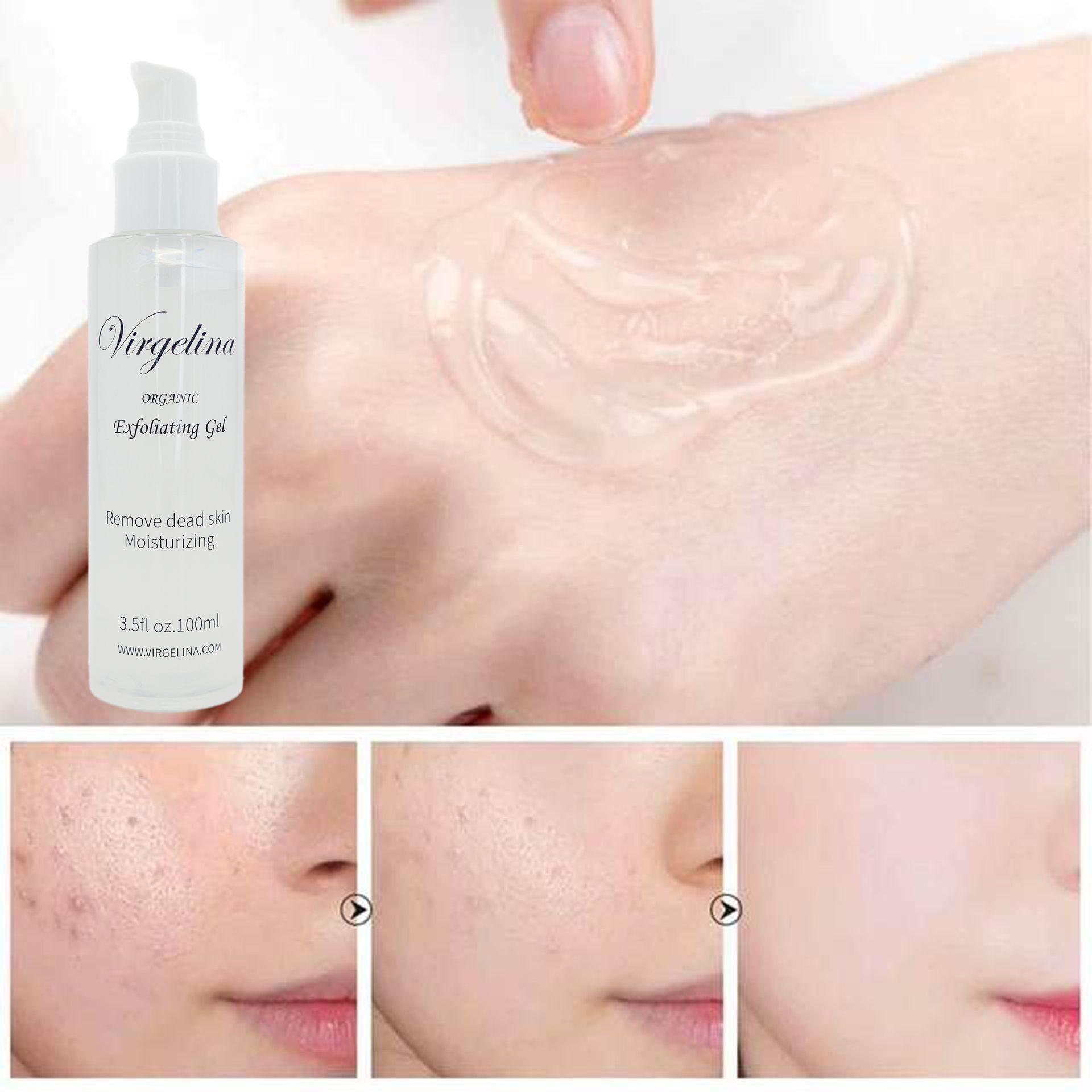 Virgelina Exfoliating Gel
