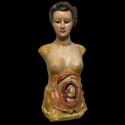 Exceptional anatomical plaster and wax maternity sculpture, Germany, 19th century