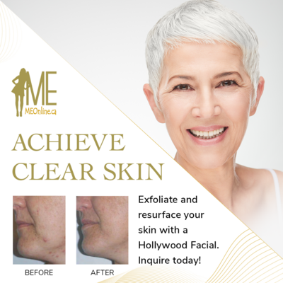 Facial Contouring &amp; Tightening