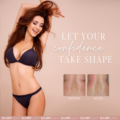 Body Transformation Series