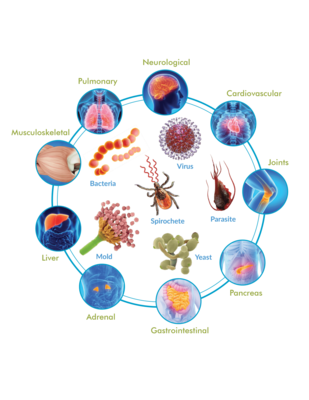 Cyrex Array 12 - Pathogen-Associated Immune Reactivity Screen Cyrex Array 12 - Pathogen-Associated Immune Reactivity Screen