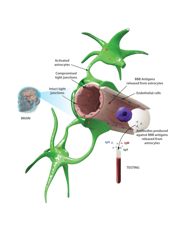 Cyrex Array 20 - Blood Brain Barrier Permeability